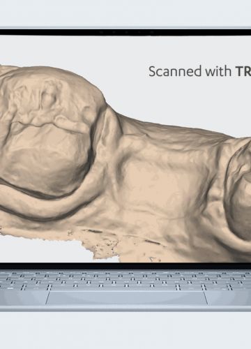 Jaunums - 3Shape TRIOS 6 intraorālais skeneris