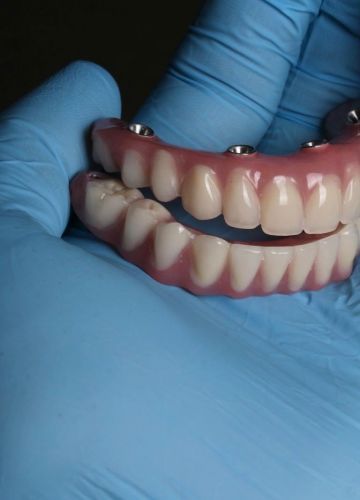 Abu žokļa zobu rindu atjaunošana